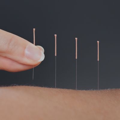 ACUPUNCTURE / TRADITIONAL CHINESE MEDICINE - Balance Complimentary Medicine