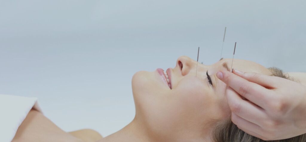 Acupuncturist Near Bayside | Best Acupuncture Clinic In Melbourne